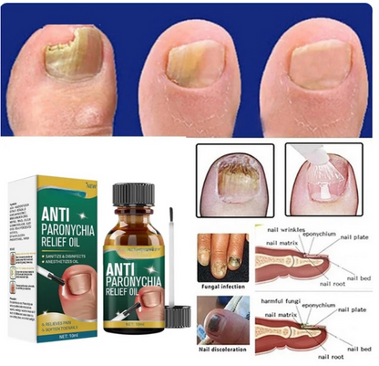 Anti Paronychia Relief Oil- Buy 1 Get 1 Free